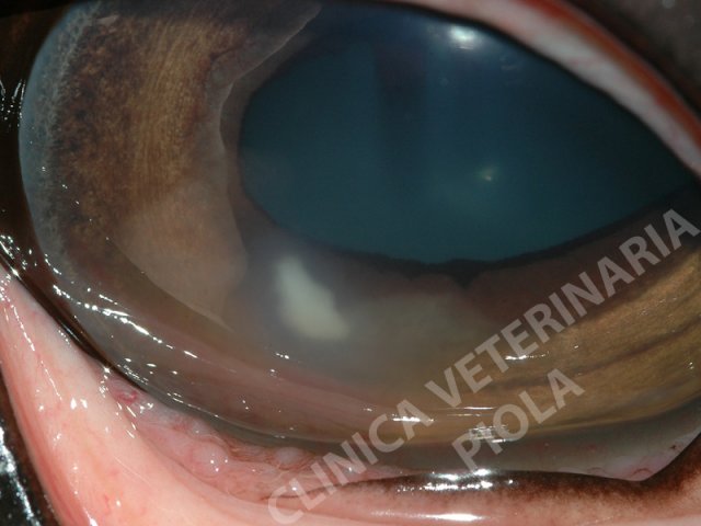 Ascesso corneale endoteliale